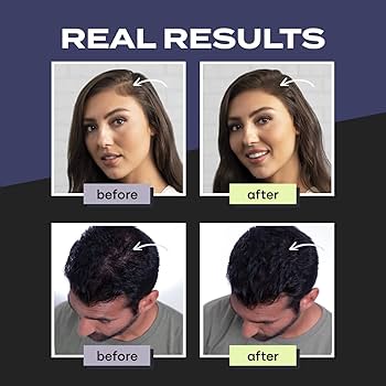 TOPIK Hair Building Fibre Dark Brown MUVAYA